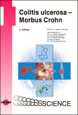 Colitis ulcerosa - Morbus Crohn - Stange, Eduard F.