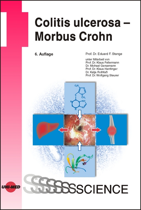 Colitis ulcerosa - Morbus Crohn - Eduard F. Stange