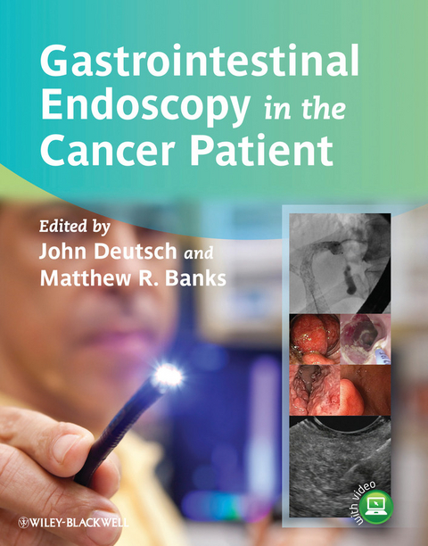 Gastrointestinal Endoscopy in the Cancer Patient - 