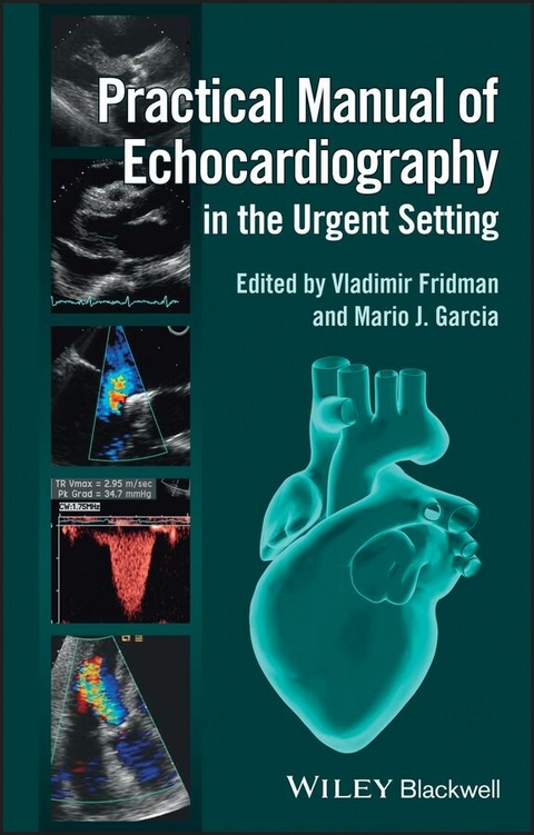 Practical Manual of Echocardiography in the Urgent Setting - 