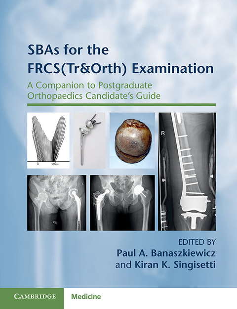 SBAs for the FRCS(Tr&Orth) Examination - 