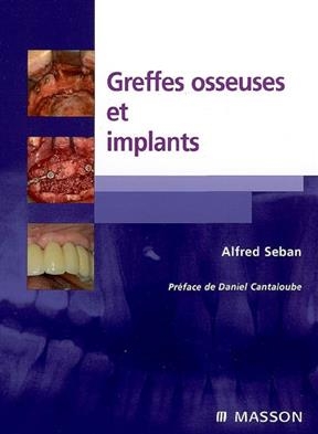 Greffes osseuses et implants - Alfred Seban