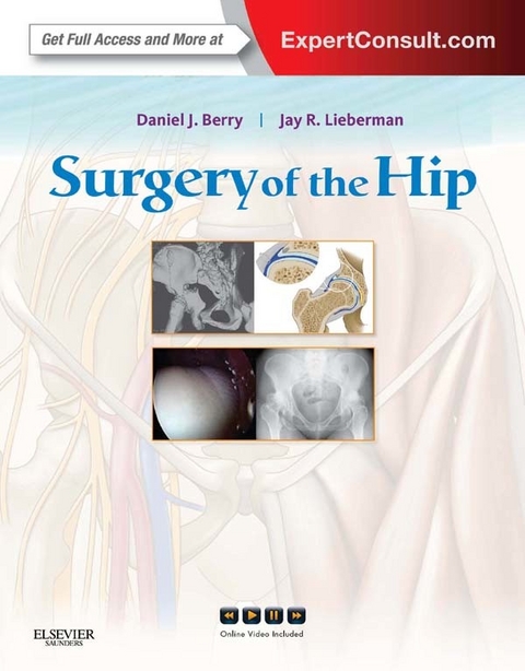 Surgery of the Hip E-Book -  Daniel J. Berry,  Jay Lieberman