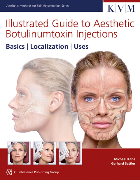 Illustrated Guide to Aesthetic Botulinum Toxin Injections - Michael Kane, Gerhard Sattler