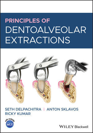 Principles of Dentoalveolar Extractions - Seth Delpachitra, Anton Sklavos, Ricky Kumar