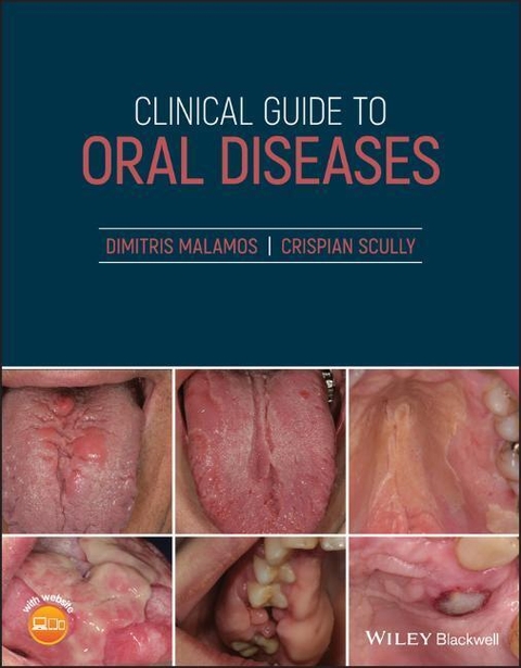 Clinical Guide to Oral Diseases - Dimitris Malamos, Crispian Scully