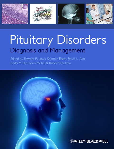 Pituitary Disorders - 