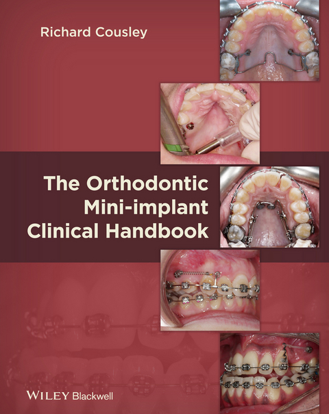 Orthodontic Mini-implant Clinical Handbook -  Richard Cousley