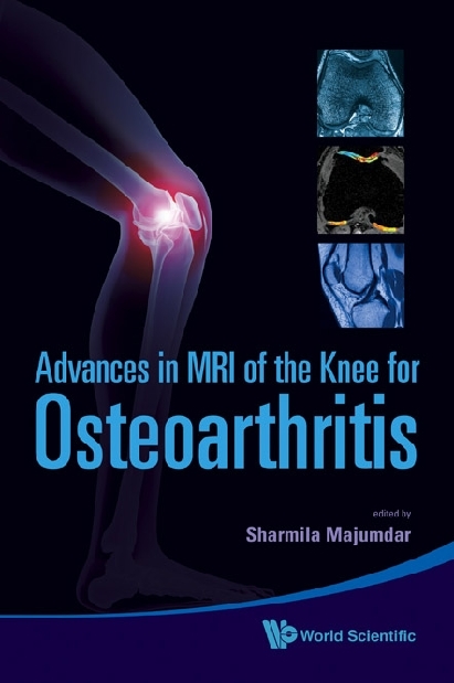 Advances In Mri Of The Knee For Osteoarthritis - 