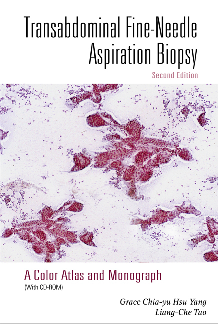Transabdominal Fine-needle Aspiration Biopsy (2nd Edition): A Color Atlas And Monograph (With Cd-rom) - Grace C H Yang, Liang-Che Tao