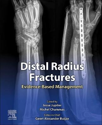 Distal Radius Fractures - 
