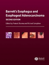 Barrett's Esophagus and Esophageal Adenocarcinoma - 