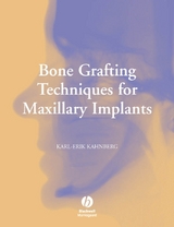 Bone Grafting Techniques for Maxillary Implants -  Karl-Erik Kahnberg