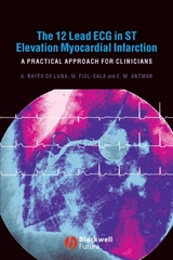 12 Lead ECG in ST Elevation Myocardial Infarction -  Elliot M. Antman,  Miquel Fiol-Sala,  Antoni Bay s de Luna