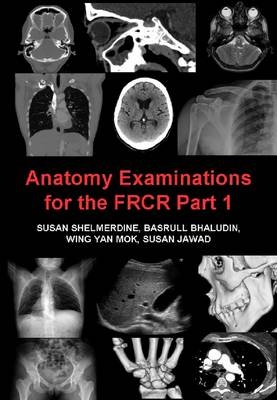 Anatomy Examinations for the FRCR Part 1 -  Susan Shelmerdine