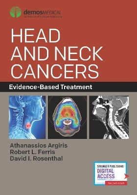 Head and Neck Cancers - 