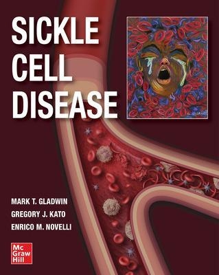 Sickle Cell Disease - Mark T. Gladwin, Gregory J. Kato, Gregory Kato, Enrico M. Novelli
