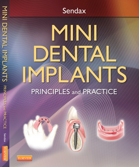 Mini Dental Implants -  Victor Dr. Sendax