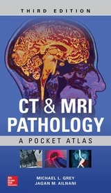 CT & MRI Pathology: A Pocket Atlas, Third Edition - Grey, Michael; Ailinani, Jagan
