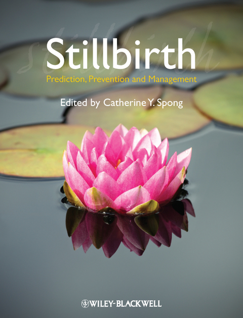 Stillbirth - 