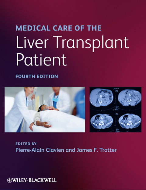 Medical Care of the Liver Transplant Patient - 
