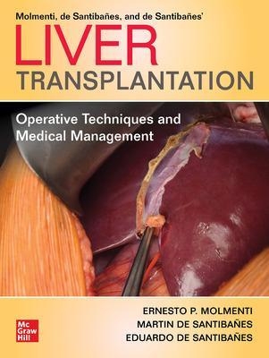 Liver Transplantation: Operative Techniques and Medical Management - Ernesto P. Molmenti, Martin de Santibañes, Eduardo de Santibañes
