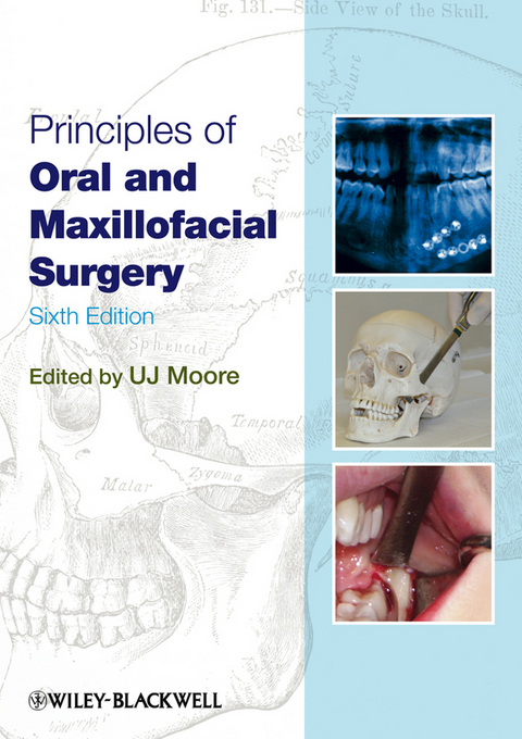 Principles of Oral and Maxillofacial Surgery -  U. J. Moore