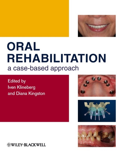 Oral Rehabilitation - 