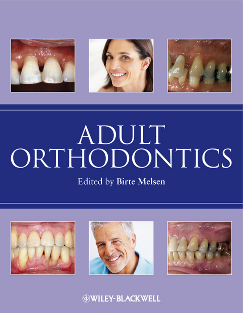Adult Orthodontics - 