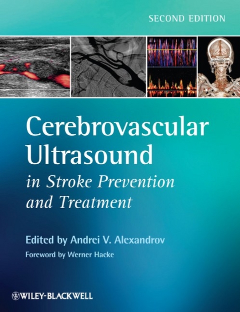 Cerebrovascular Ultrasound in Stroke Prevention and Treatment - 