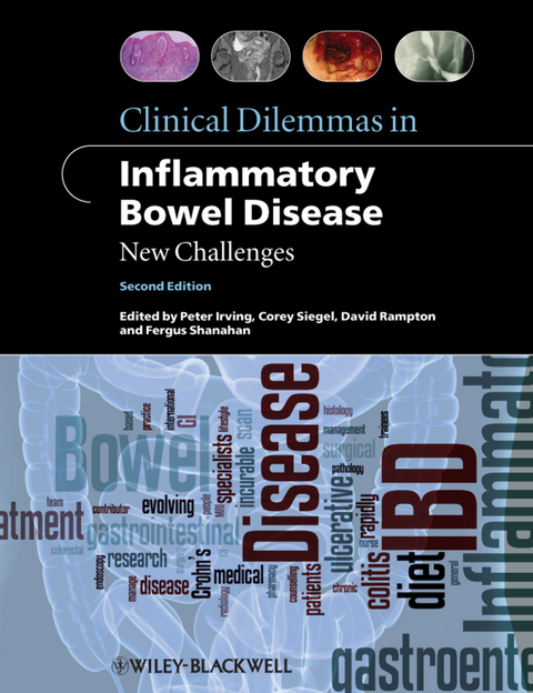 Clinical Dilemmas in Inflammatory Bowel Disease - 