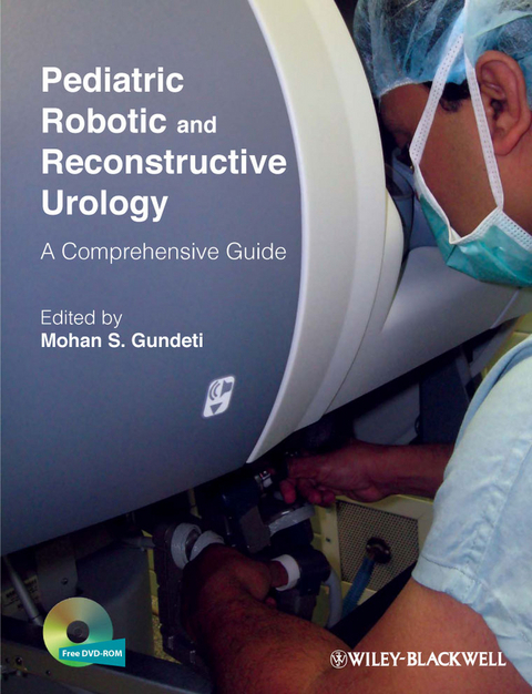 Pediatric Robotic and Reconstructive Urology - 