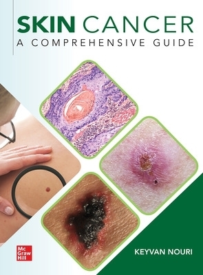 Skin Cancer: A Comprehensive Guide - Keyvan Nouri