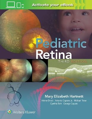 Pediatric Retina - Mary Elizabeth Hartnett