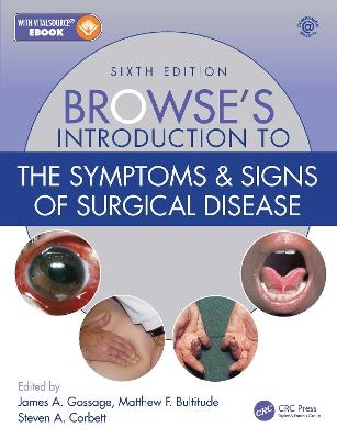 Browse's Introduction to the Symptoms & Signs of Surgical Disease - 
