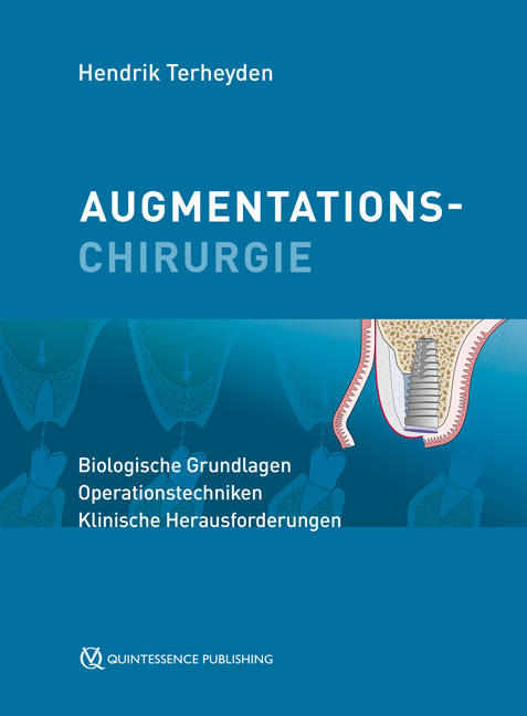 Augmentationschirurgie - Hendrik Terheyden