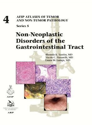 Non-Neoplastic Disorders of the Gastrointestinal Tract - Rhonda K. Yantiss, Nicole C. Panarelli, Laura W. Lamps