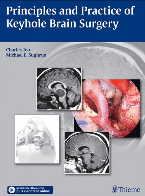 Principles and Practice of Keyhole Brain Surgery - Charles Teo, Michael E. Sughrue