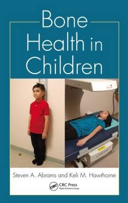 Bone Health in Children -  Steven A. Abrams,  Keli M. Hawthorne