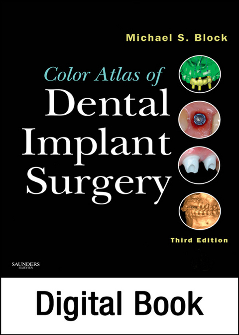 Color Atlas of Dental Implant Surgery - E-Book -  Michael S. Block