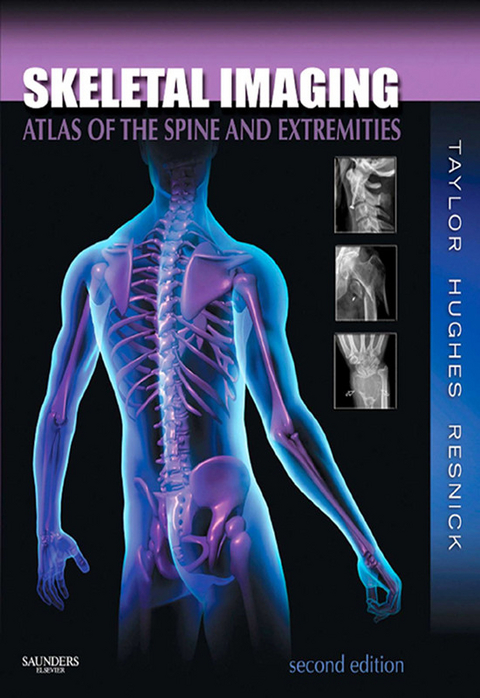 Skeletal Imaging -  Tudor H. Hughes,  Donald L. Resnick,  John A. M. Taylor