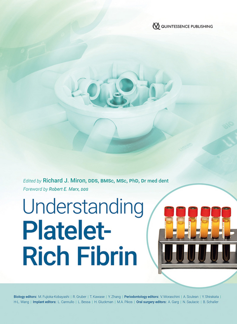 Understanding Platelet-Rich Fibrin - Richard J Miron