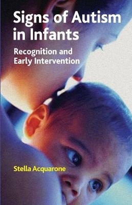 Signs of Autism in Infants - 