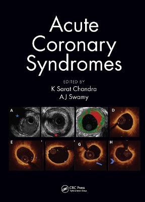 Acute Coronary Syndromes - 