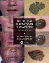 Differential Diagnosis in Dermatology - Ashton, Richard; Leppard, Barbara