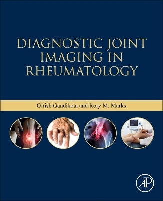 Diagnostic Joint Imaging in Rheumatology - Girish Gandikota, Rory M. Marks