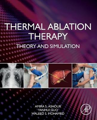 Thermal Ablation Therapy - Amira S. Ashour, Yanhui Guo, Waleed S. Mohamed