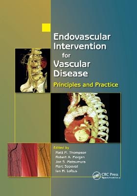 Endovascular Intervention for Vascular Disease - 