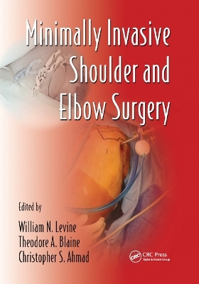 Minimally Invasive Shoulder and Elbow Surgery - 