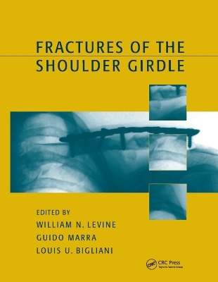Fractures of the Shoulder Girdle - William N. Levine, Guido Marra